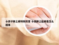 小孩子脚上癣特别厉害 小孩脚上起癣是怎么回事