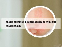 苏州看皮肤科哪个医院最好的医院 苏州看皮肤科哪里最好