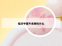 临沂中医牛皮癣吃什么