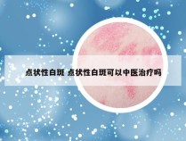 点状性白斑 点状性白斑可以中医治疗吗