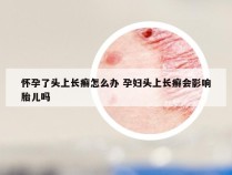 怀孕了头上长癣怎么办 孕妇头上长癣会影响胎儿吗