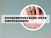 郑州市银屑病研究所是不是正规的 郑州市银屑病研究所是正规医院吗