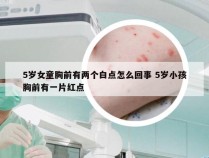 5岁女童胸前有两个白点怎么回事 5岁小孩胸前有一片红点