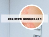 膝盖处深色的癣 膝盖有癣是什么原因