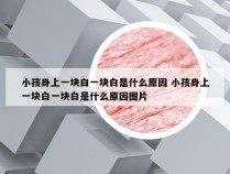 小孩身上一块白一块白是什么原因 小孩身上一块白一块白是什么原因图片