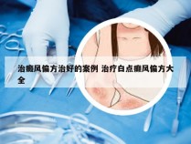 治癜风偏方治好的案例 治疗白点癫风偏方大全