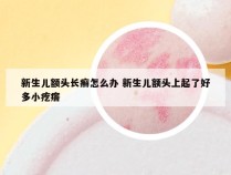 新生儿额头长癣怎么办 新生儿额头上起了好多小疙瘩