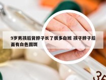 9岁男孩后背脖子长了很多白班 孩子脖子后面有白色圆斑