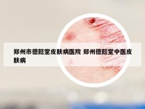 郑州市德懿堂皮肤病医院 郑州德懿堂中医皮肤病