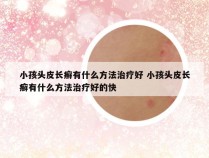 小孩头皮长癣有什么方法治疗好 小孩头皮长癣有什么方法治疗好的快