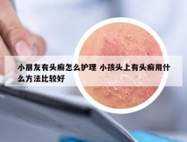 小朋友有头癣怎么护理 小孩头上有头癣用什么方法比较好