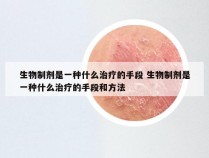 生物制剂是一种什么治疗的手段 生物制剂是一种什么治疗的手段和方法