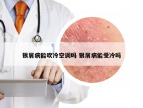 银屑病能吹冷空调吗 银屑病能受冷吗