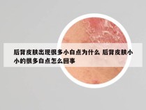 后背皮肤出现很多小白点为什么 后背皮肤小小的很多白点怎么回事