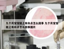 九个月宝宝腿上有白点怎么回事 九个月宝宝腿上有白点怎么回事图片