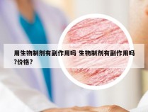 用生物制剂有副作用吗 生物制剂有副作用吗?价格?