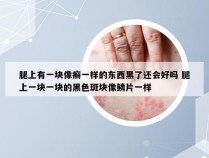 腿上有一块像癣一样的东西黑了还会好吗 腿上一块一块的黑色斑块像鳞片一样