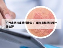 广州市医院皮肤科排名 广州市皮肤医院哪个医生好