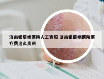 济南银屑病医院人工客服 济南银屑病医院医疗费这么贵啊