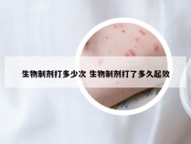 生物制剂打多少次 生物制剂打了多久起效