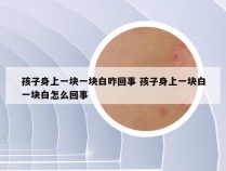 孩子身上一块一块白咋回事 孩子身上一块白一块白怎么回事