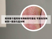 西安那个医院有生物制剂可善挺 可善挺生物制剂一般多久起效呢