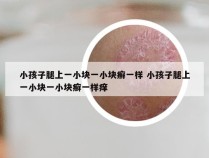 小孩子腿上一小块一小块癣一样 小孩子腿上一小块一小块癣一样痒