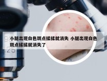 小腿出现白色斑点揉揉就消失 小腿出现白色斑点揉揉就消失了