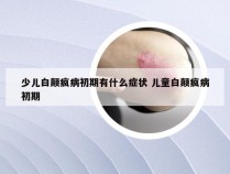 少儿白颠疯病初期有什么症状 儿童白颠疯病初期