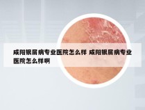 咸阳银屑病专业医院怎么样 咸阳银屑病专业医院怎么样啊