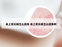 身上常长癣怎么回事 身上常长癣怎么回事啊