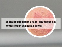 肠溃疡打生物制剂的人多吗 溃疡性结肠炎用生物制剂能切底治好吗不复发吗