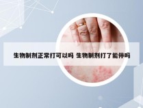 生物制剂正常打可以吗 生物制剂打了能停吗