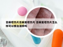 百癣塔热片百癣夏塔热片 百癣夏塔热片怎么样可以根治湿疹吗