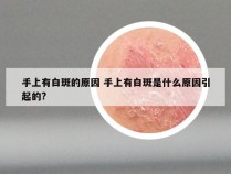 手上有白斑的原因 手上有白斑是什么原因引起的?