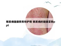 银屑病健康教育和护理 银屑病的健康宣教ppt