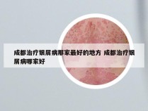 成都治疗银屑病那家最好的地方 成都治疗银屑病哪家好