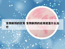 生物制剂的优势 生物制剂的应用就是什么治疗