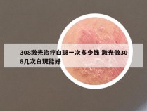 308激光治疗白斑一次多少钱 激光做308几次白斑能好