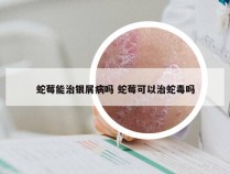 蛇莓能治银屑病吗 蛇莓可以治蛇毒吗