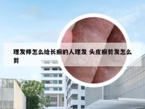 理发师怎么给长癣的人理发 头皮癣剪发怎么剪