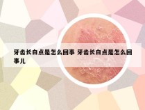 牙齿长白点是怎么回事 牙齿长白点是怎么回事儿