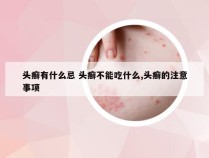 头癣有什么忌 头癣不能吃什么,头癣的注意事项