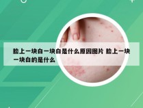 脸上一块白一块白是什么原因图片 脸上一块一块白的是什么