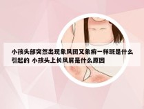 小孩头部突然出现象风团又象癣一样斑是什么引起的 小孩头上长风屑是什么原因