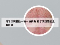 用了淡斑霜脸一块一块的白 用了淡斑霜脸上有白斑