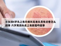 小女孩6岁头上有片癣长出来头发有点卷怎么回事 六岁男孩头皮上有藓是咋回事