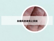 白癜风患者网上家园