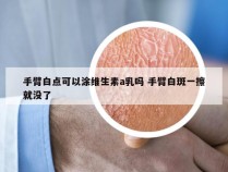 手臂白点可以涂维生素a乳吗 手臂白斑一擦就没了