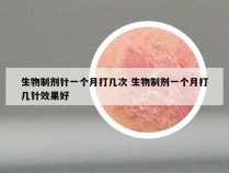 生物制剂针一个月打几次 生物制剂一个月打几针效果好